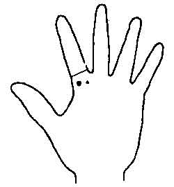 Lines and Signs on Mounts