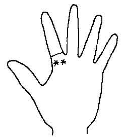 Lines and Signs on Mounts