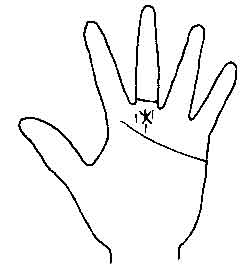 Lines and Signs on Mounts