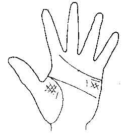 Lines and Signs on Mounts